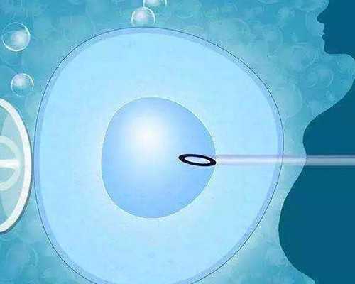 海南代孕辅助生殖中心选性别,海南试管婴儿(海南试管婴儿医院排名哪家好)