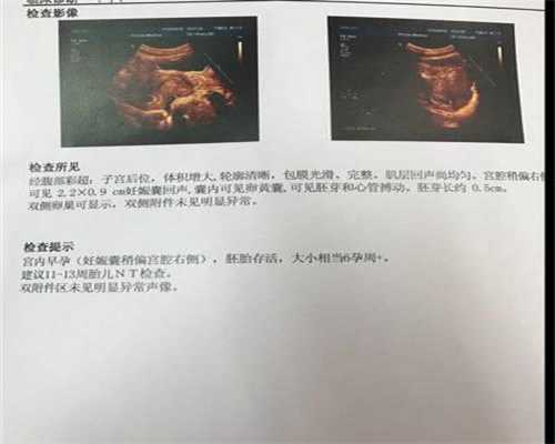 北京代怀孕中介_北京代孕中心官方网站_北京现在