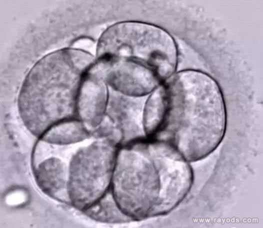 试管婴儿胚胎等级是怎么划分的