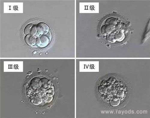 许昌借卵子子怀孕费用是多少_试管胚胎等级分类，二级胚胎是不是优质胚胎？