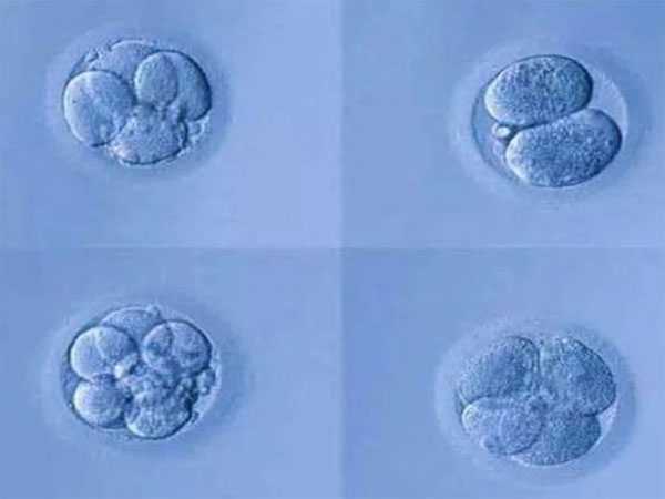 试管婴儿优胚和普胚的区别，一览本文即可熟知