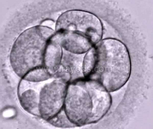 试管婴儿养囊是什么意思 哪些人适合囊胚培养